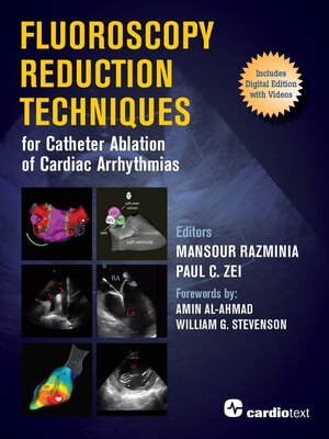 cover image of Fluoroscopy Reduction Techniques for Catheter Ablation of Cardiac Arrhythmias